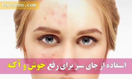 درمان جوش صورت با عرق کاسنی , درمان جوش زیر پوستی