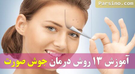 درمان جوش صورت با گلاب , درمان جوش صورت بعد از اصلاح
